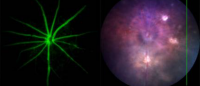 images of retina after treatment for RVO with Caspase-9 inhibitor